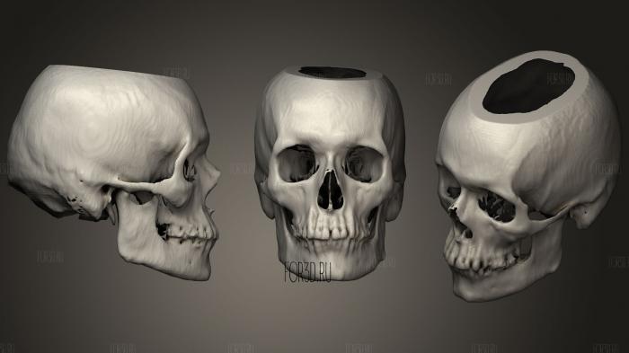 Skull Male 72yo stl model for CNC